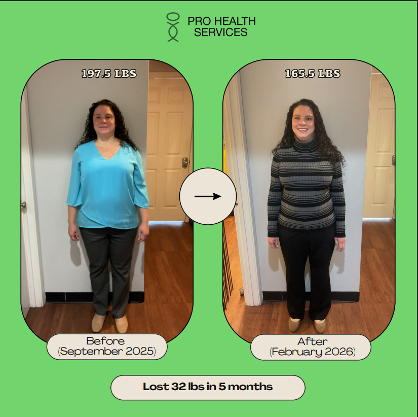 Before And After Photo From Front