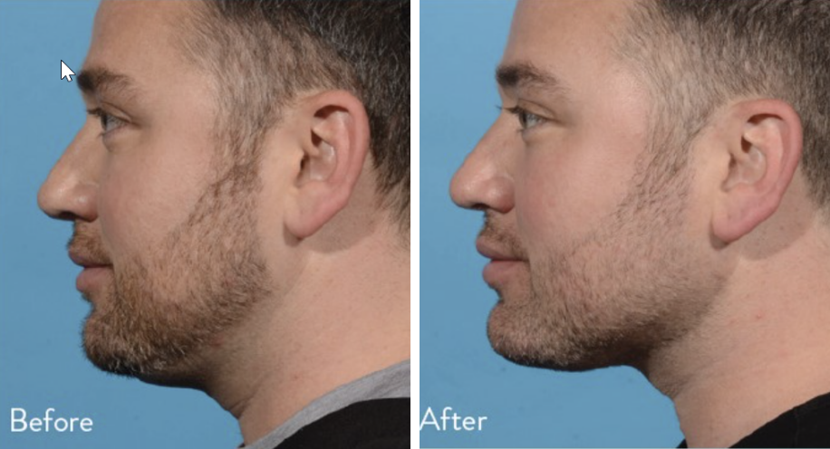 DrAngelAlexander-ProHealthServices-Anti-Aging-Facial-Treatments1-April2026