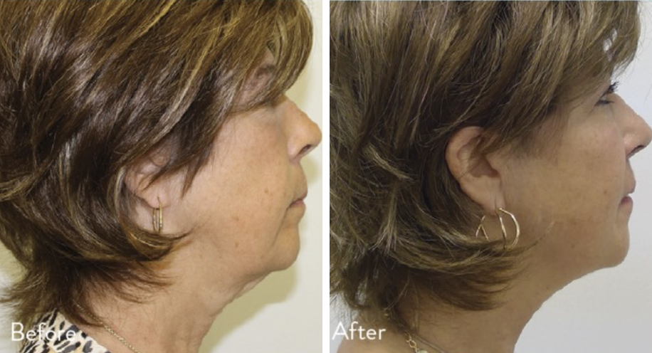 DrAngelAlexander-ProHealthServices-Anti-Aging-Facial-Treatments2April2026