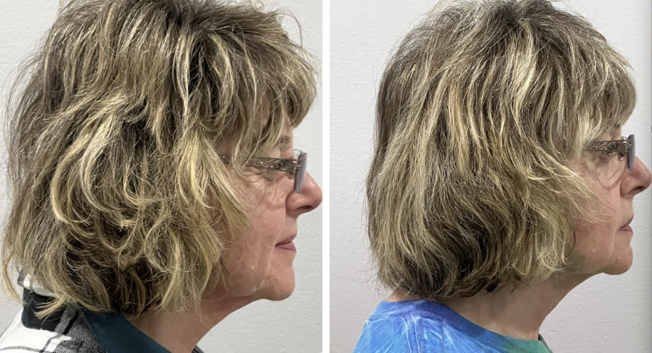 DrAngelAlexander-ProHealthServices-Anti-Aging-Facial-Treatments3-April2026