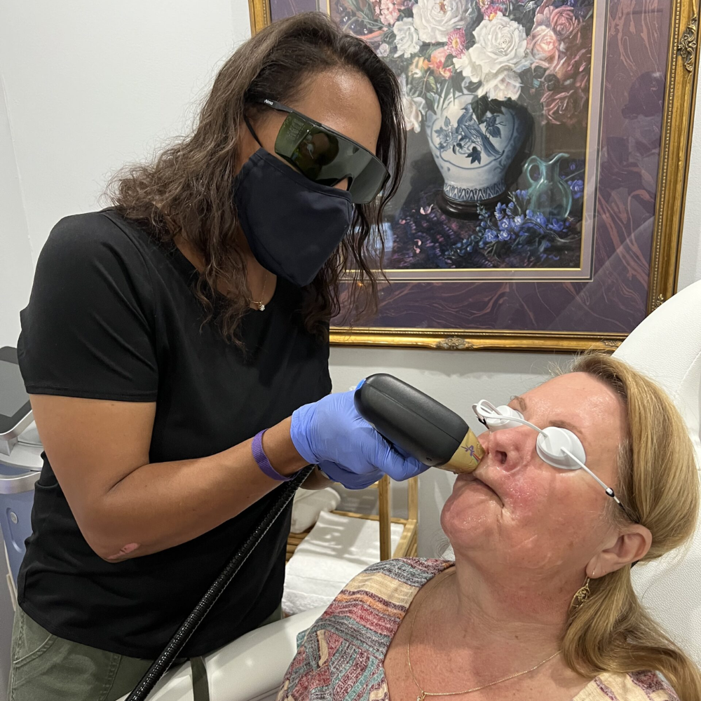 Dr A performing a Soprano Laser hair Removal on a patient's upper lip, designated as a small area.